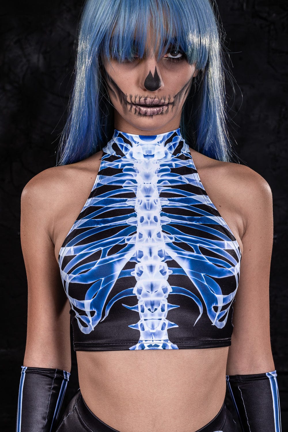 X-Ray Skeleton Fit Top